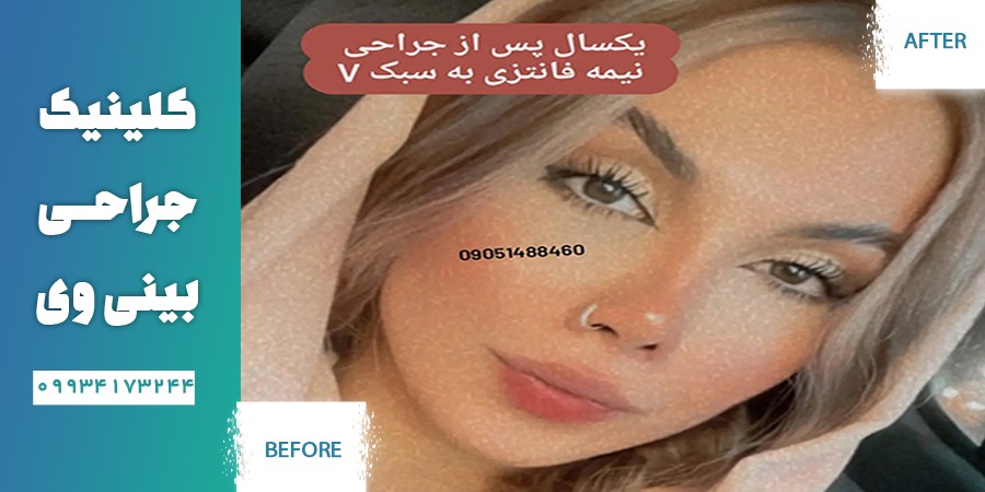 بهترین جراح بینی فانتزی در تهران