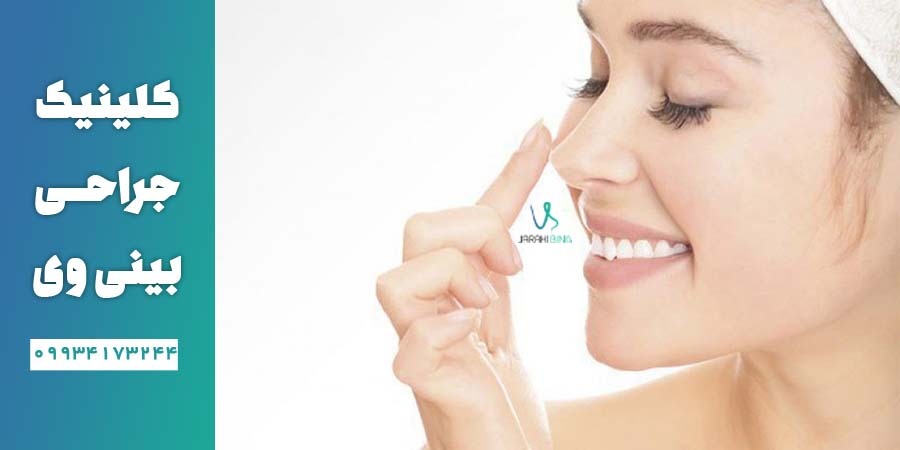 مراقبت های قبل از عمل بینی شامل موارد بسیاری می شود.