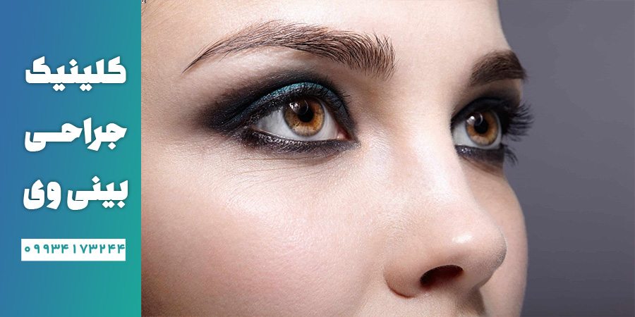 جراحی بینی به روش باز