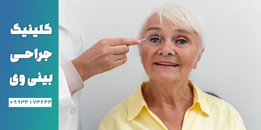 سن عمل بینی