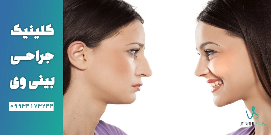 عمل بینی در سن بزرگسالی