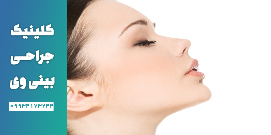 بهترین جراح بینی در سعادت آباد