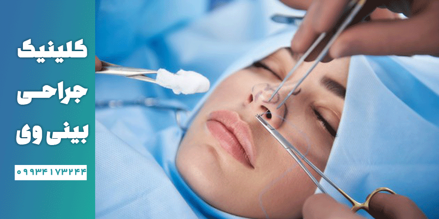 تفاوت جراحی بینی به روش باز و بسته 