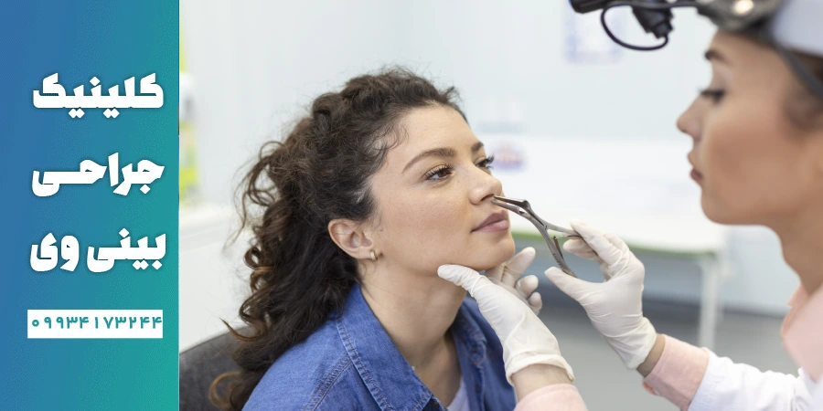 کاندید عمل باز و بسته