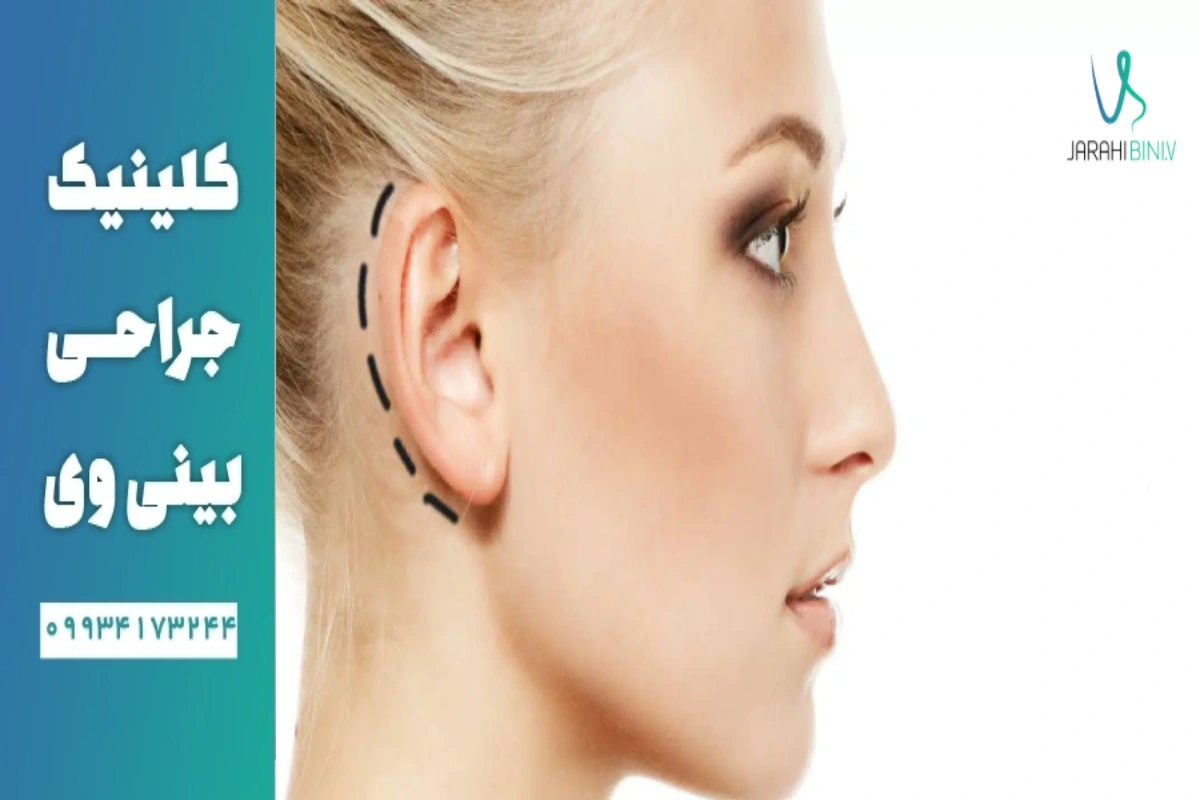 عمل جراحی زیبایی گوش