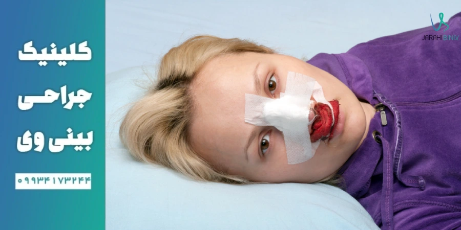 موارد احتیاطی <yoastmark class=