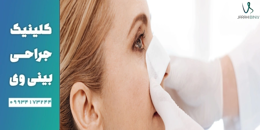 اطلاع از جزئیات و روند جراحی بینی