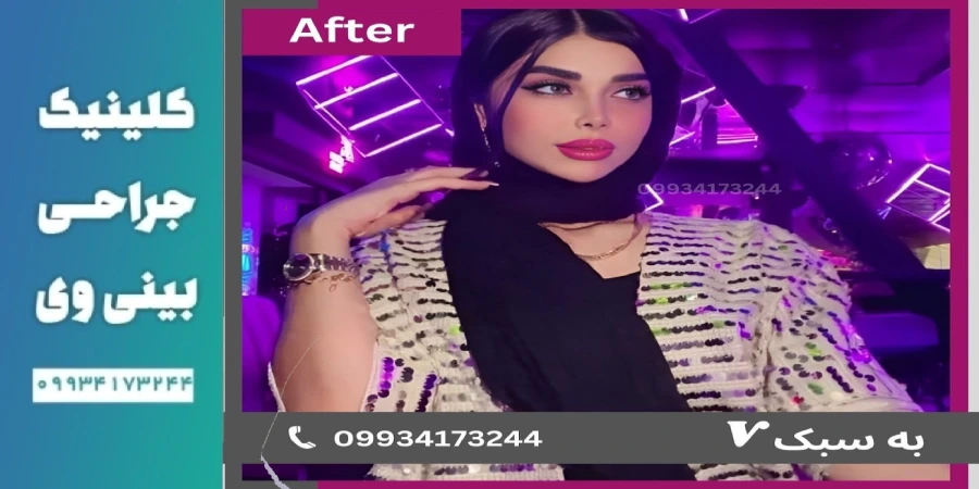 بهترین جراح بینی طبیعی در تهران- دکتر آرزو خوانساری (1)