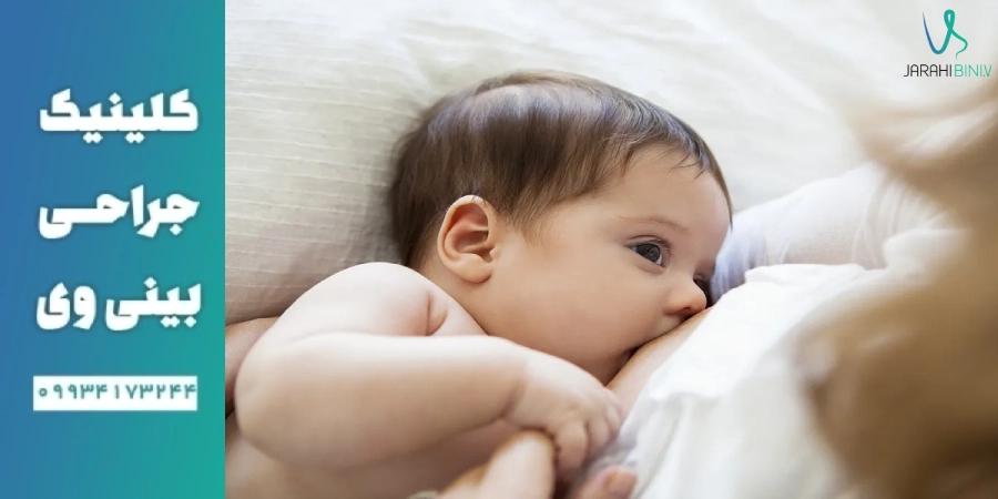 تاثیر جراحی_ بینی بر شیردهی- دکتر آرزو خوانساری