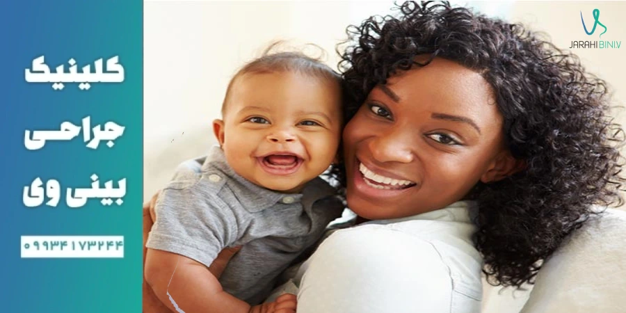 نکاتی برای کاهش تاثیر جراحی_ بینی بر شیردهی نوزاد