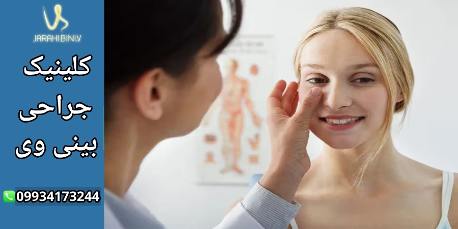 تعیین ویژگی‌های بینی ایده آل