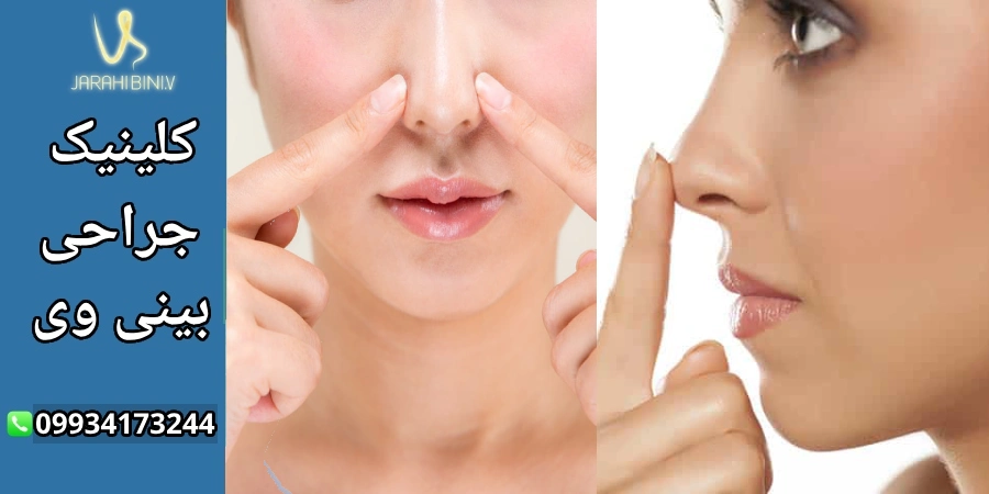 نمای نیم و تمام رخ یک بینی ایده آل