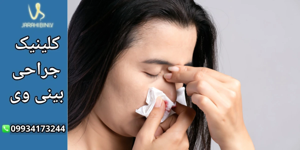 دکتر آرزو خوانساری-خونریزی پس از جراحی بینی