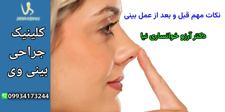 نکات مهم قبل و بعد از عمل بینی- دکتر آرزو خوانساری نیا