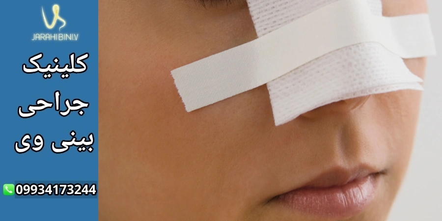 خشکی بینی بعد از عمل بینی- دکتر آرزو خوانساری نیا