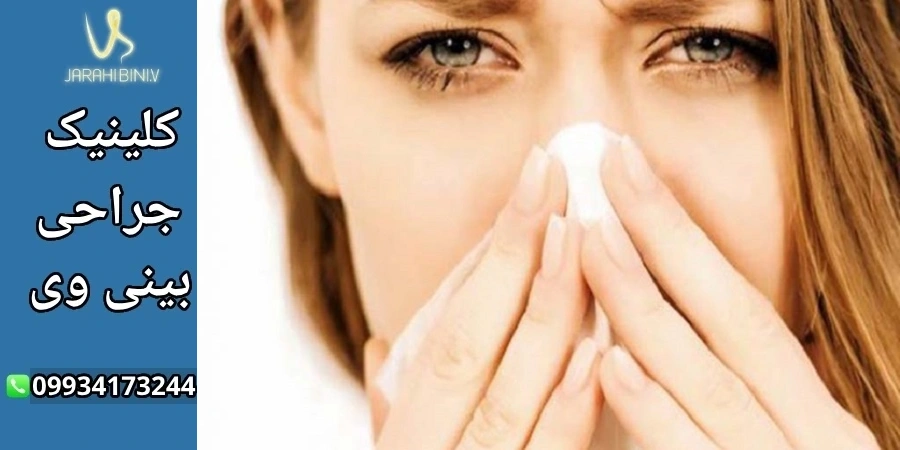 آبریزش بعد از جراحی بینی- دکتر آرزو خوانساری نیا