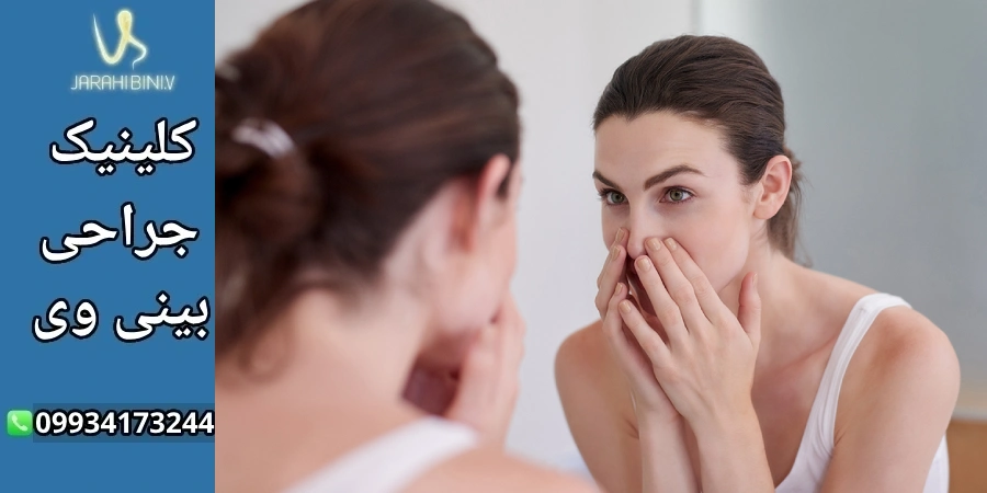 روند بهبودی عمل بینی- دکتر آرزو خوانساری