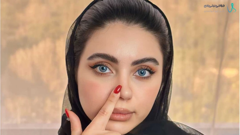 علائم هشدار بعد از جراحی بینی