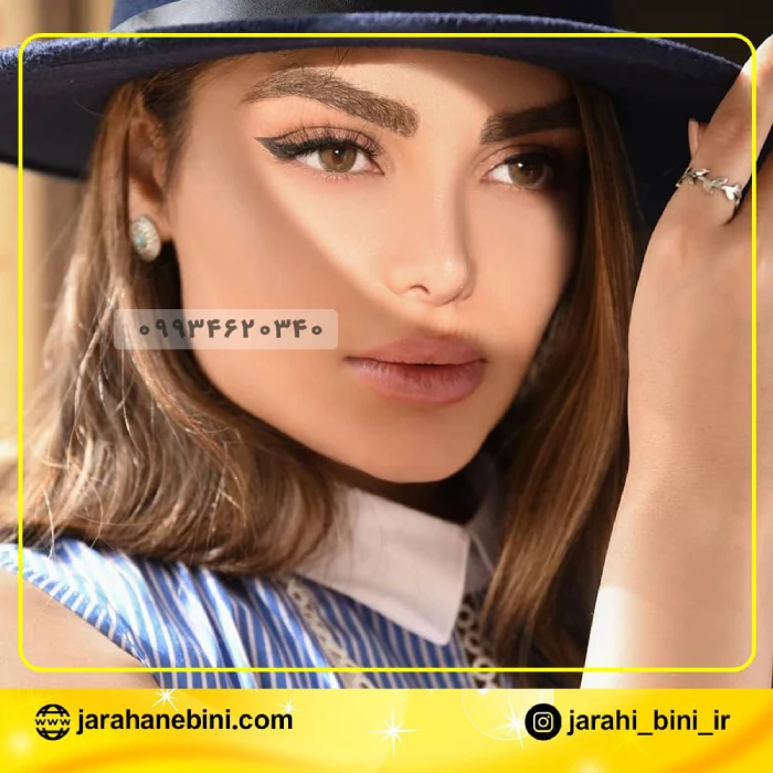 اصلاح قوز و تقویت غضروف در جراحی بینی گوشتی | دکتر اکبر اعتمادی