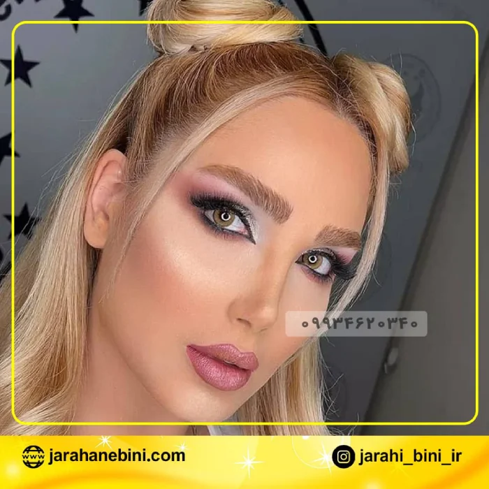 طراحی طبیعی بینی با حفظ تناسب چهره | دکتر اکبر اعتمادی