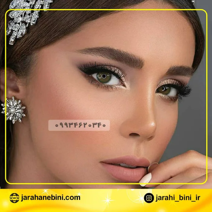 نیمه‌فانتزی ظریف در جراحی بینی گوشتی | دکتر اکبر اعتمادی