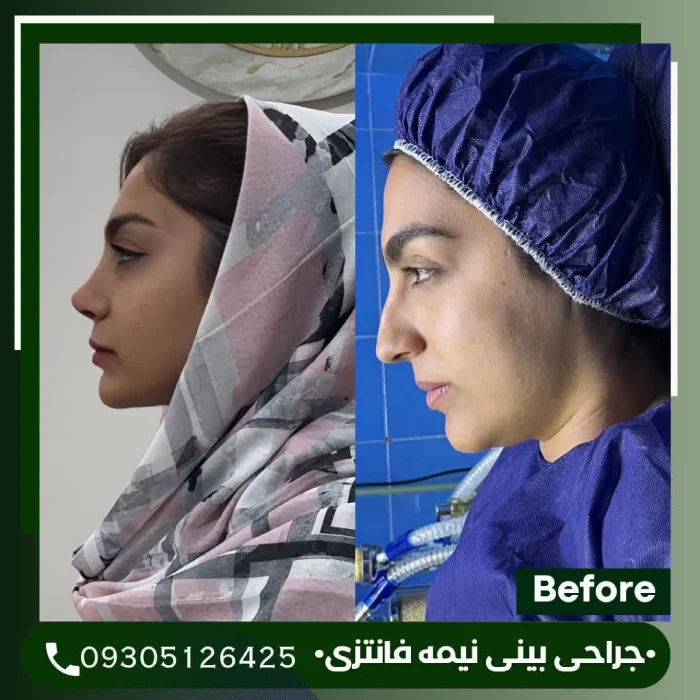 نیمه‌فانتزی ظریف برای بینی گوشتی | دکتر علی شکرریز