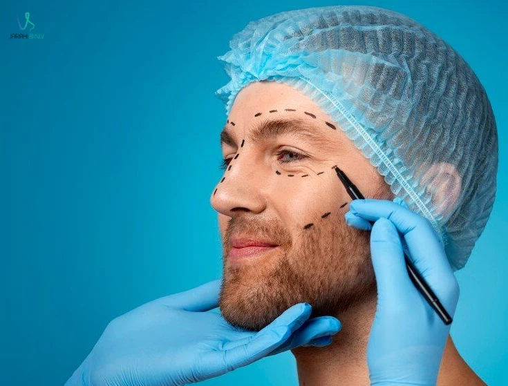 جراحی بینی گوشتی مردانه در تهران؛ حفظ فرم مردانه و تناسب با اجزای چهره