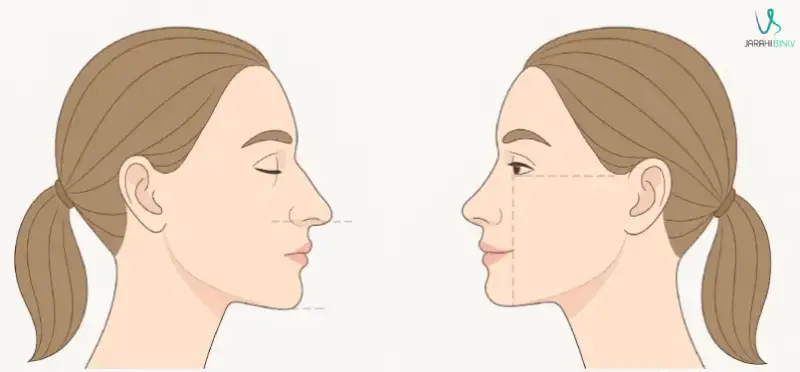 تحلیل سبک فرم‌دهی بینی در نمونه‌کارهای دکتر امین بختیاری