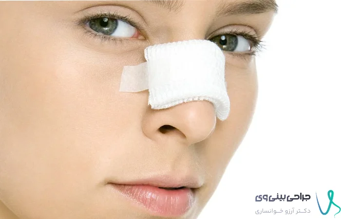 بازگشت بینی بعد از عمل جراحی بینی- دکتر آرزو خوانساری نیا