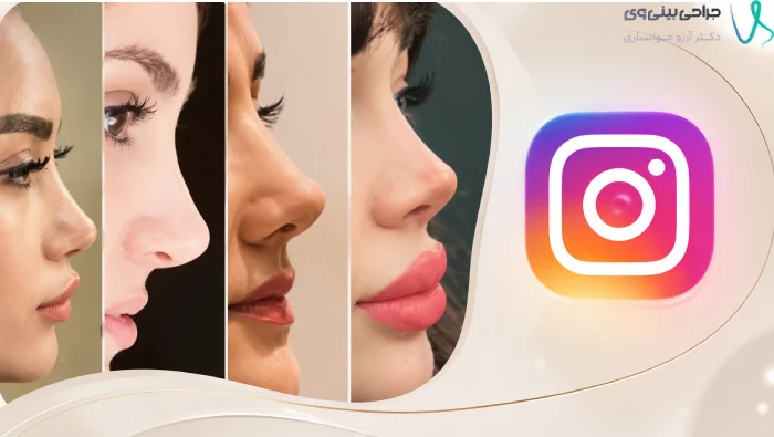 چطور نمونه‌کارها و پیج اینستاگرام جراح بینی را بررسی کنیم؟