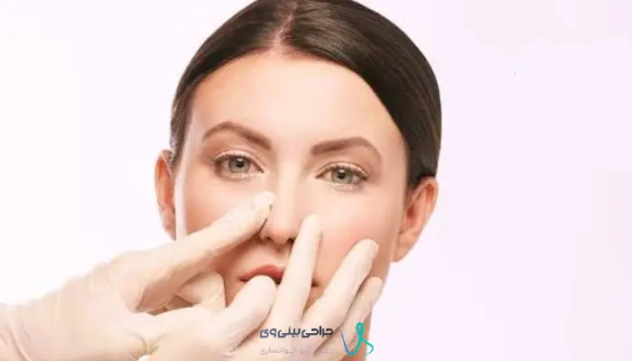 ارزیابی فرم ظاهری و عملکرد تنفسی پیش از عمل ترمیمی بینی