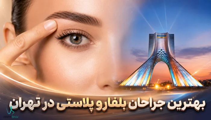 بهترین جراح بلفاروپلاستی در تهران