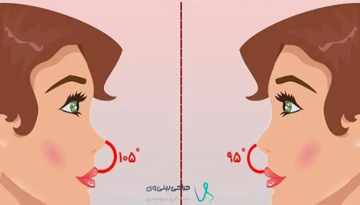 مقایسه فرم بینی طبیعی نیمه فانتزی و فانتزی