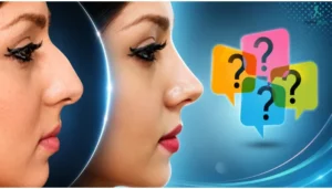 چطور بفهمیم بینی گوشتی داریم یا استخوانی- دکتر آرزو خوانساری