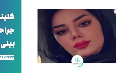 عمل بینی ترمیمی