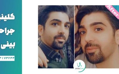 بهترین جراح بینی در تهران