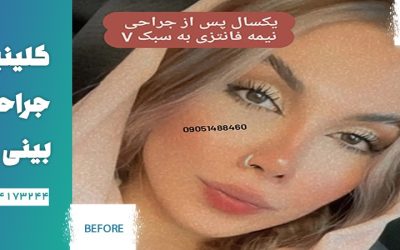 بهترین جراح بینی فانتزی در تهران