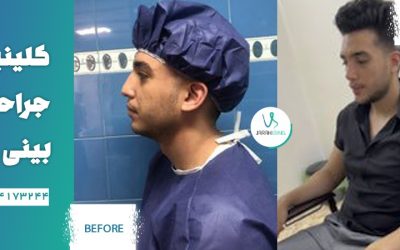 عوارض جراحی بینی