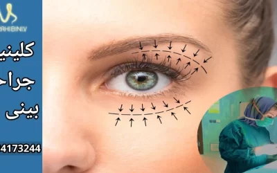 بهترین جراح بلفاروپلاستی در تهران- دکتر آرزو خوانساری نیا