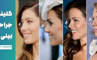 تفاوت عمل فانتزی و نیمه فانتزی