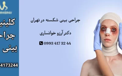 جراحی بینی شکسته در تهران- دکتر آرزو خوانساری نیا