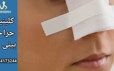 خشکی بینی بعد از عمل بینی- دکتر آرزو خوانساری نیا