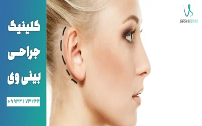 عمل جراحی زیبایی گوش