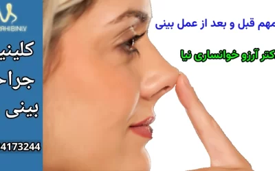 نکات مهم قبل و بعد از عمل بینی- دکتر آرزو خوانساری نیا